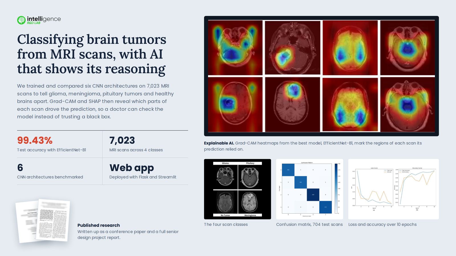 Brain tumor classification showcase: Grad-CAM heatmaps, confusion matrix and training curves